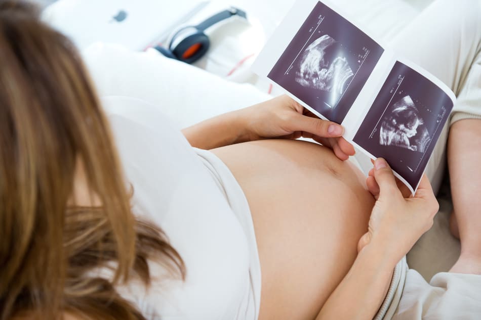 Pregnant woman looking at ultrasound scan of baby